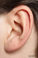 Ear Surgery  -  Otoplasty | Manhattan | New York City